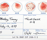 DIY Blood Typing Test