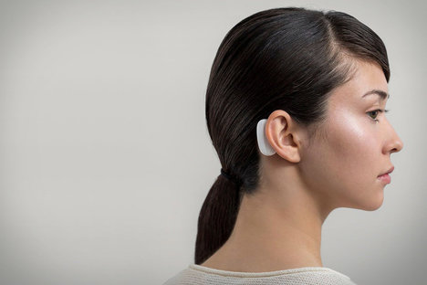 Neuralink N1植込み型センサー